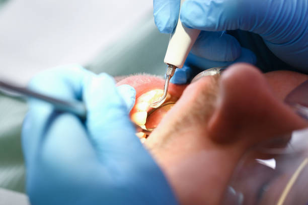 Best Emergency Treatment for Toothache in Briggs, OK